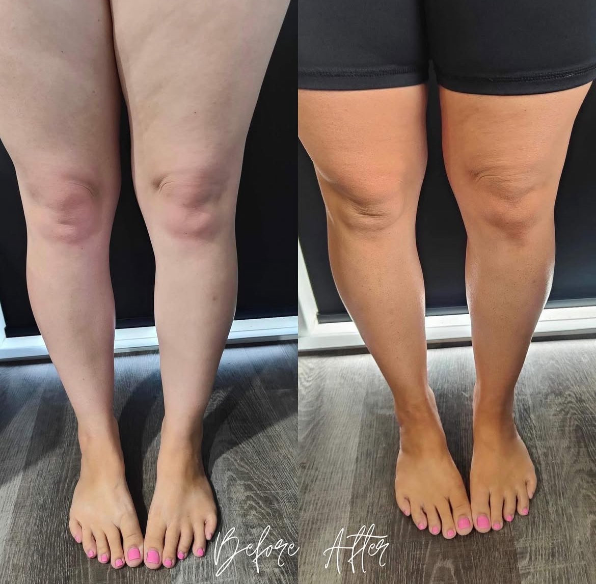ULTRA DARK TAN